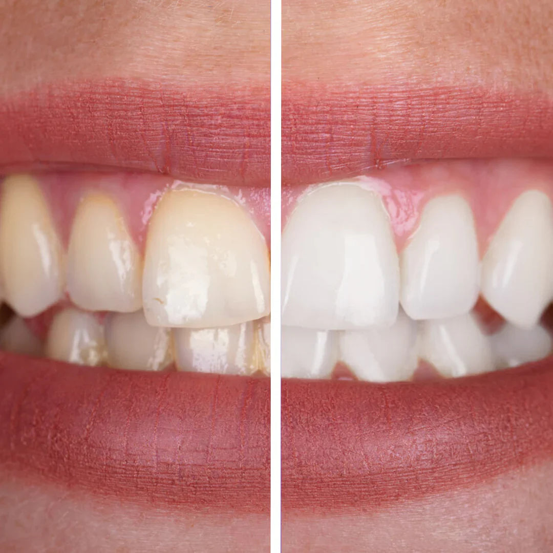 HomeVision Purple Toothpaste | For a whiter, brighter smile